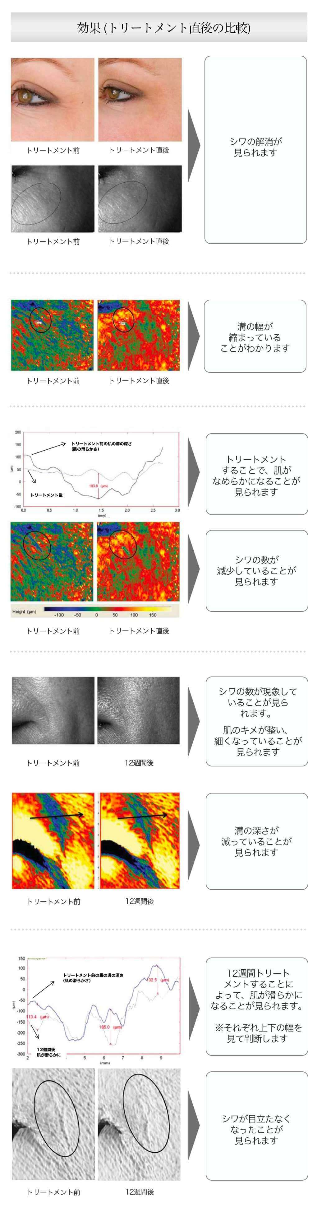 測定レポート