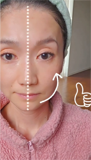 筋肉マッサージを行っている美顔器の画像
